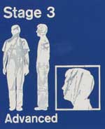 Stage 3 Advanced
